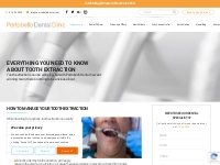 Tooth Extraction | Dental Surgery | Portobello Dental