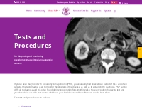 Tests and procedures   Pseudomyxoma Survivor
