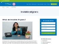 Best Invisible Aligners in Rajkot, India, Gujarat | CDH #1