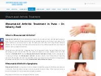 Rheumatoid Arthritis Treatment in Pune | Rheumatoid Arthritis Speciali