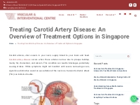 Treating Carotid Artery Disease: An Overview of Treatment Options in S