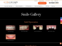 Smile Gallery - Before/After Smile Makeovers | Smile Concepts