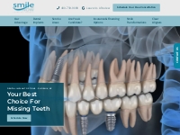 Dental Implant Specialist Phoenix, AZ | Teeth Implants