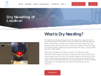 Dry Needling of Loudoun - NOVA Chiropractic   Rehab Center