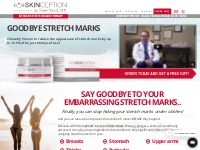 Home - Intensive Stretch Mark Therapy - Skinception by Dave David, M.D