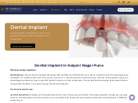 Dental Implant In Kalyani Nagar Pune | Dr. Thareja s Dental Clinic