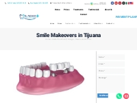 Smile Makeovers in Tijuana - Dr. Mexico