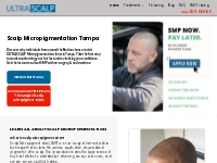            Scalp Micropigmentation Tampa - Ultra Scalp Micropigmentati
