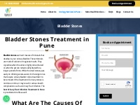 Urinary Bladder Stone Treatment in Pune | Dr. Irfan Shaikh