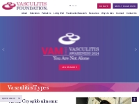 Cryoglobulinemic Vasculitis - Vasculitis Foundation