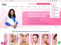 Skin Clinic | Skin Care Clinic | Acne Scar | Anti Ageing Skin Clinic