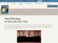 Dental Bonding | Cosmetic Dentist in Salt Lake City, UT