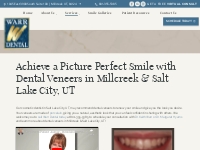Dental Veneers | Cosmetic Dentist in Salt Lake City, UT