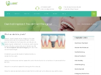 Dental Implants Treatment Nagpur | Dental Implants Deo Nagar