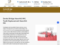 Dental Bridge Haverhill MA | Dental Bridges | Cosmetic Dentist | Call 