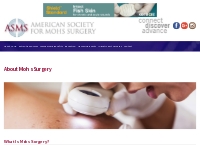Mohs Surgery Long Beach | Skin Cancer Removal Los Angeles, CA